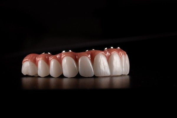 dental implants Corby
