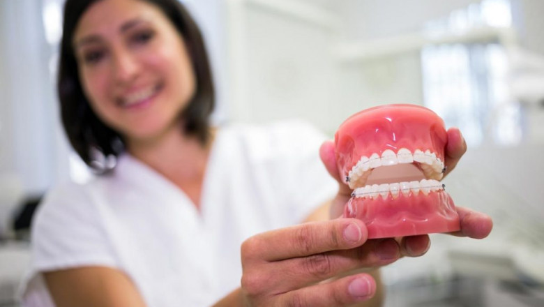 Top Questions to Ask Before Choosing Same-Day Implants