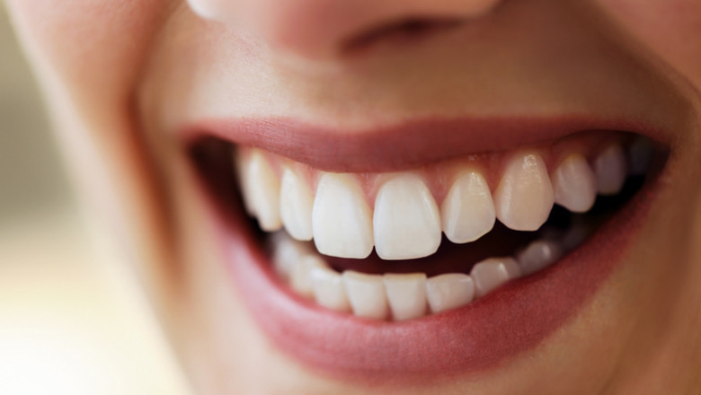 Can Gum Contouring Improve Oral Health or Just Looks?