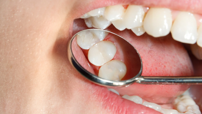 How Cosmetic Dentistry Improves Your Oral Health Alongside Appearance
