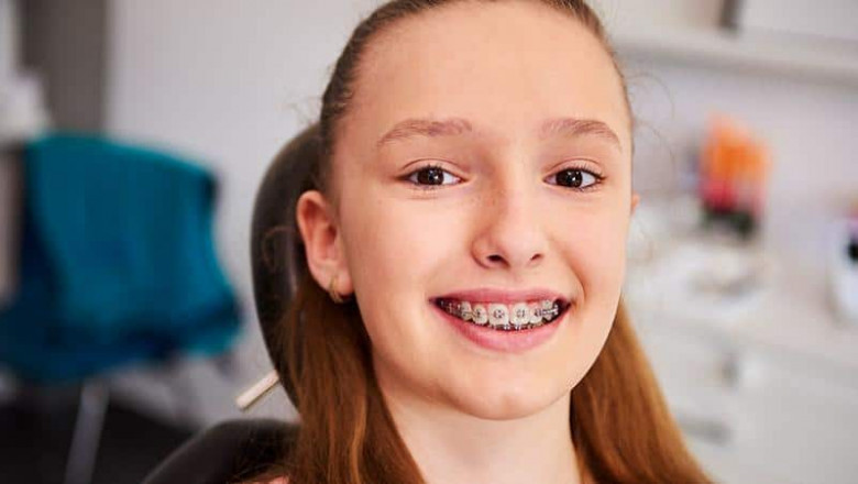 How Dubai Influencers Are Making Braces Cool Again
