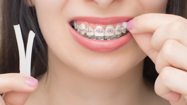 Why the Best Orthodontists Are Going Digital in 2025