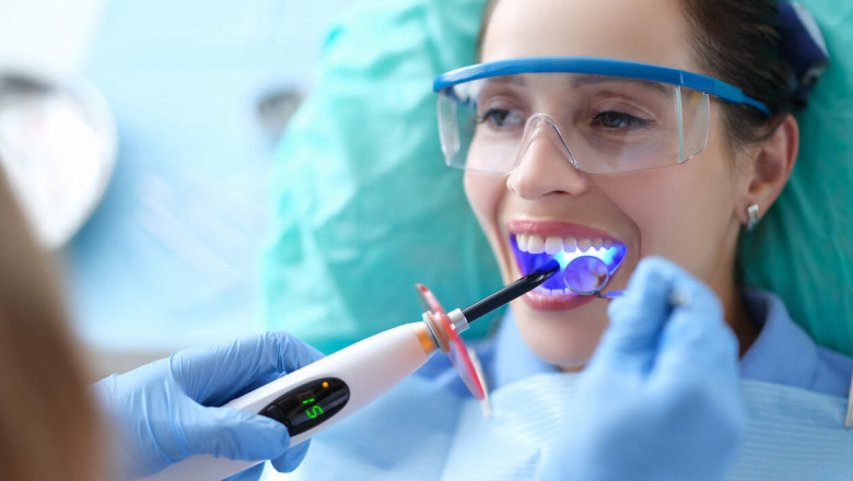 Common Myths About Composite Bonding Debunked