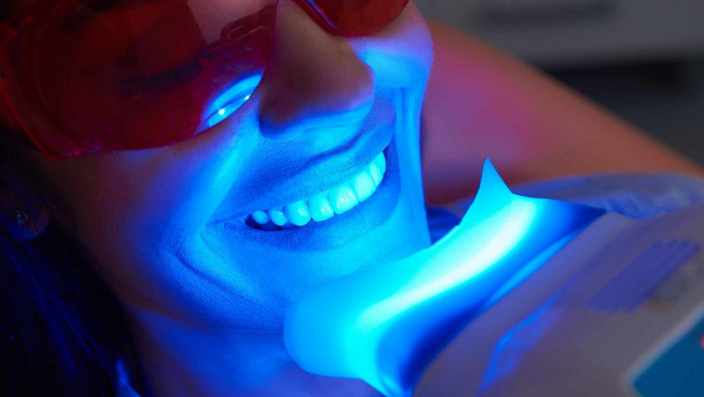 What to Do If You Experience Sensitivity After Zoom Whitening