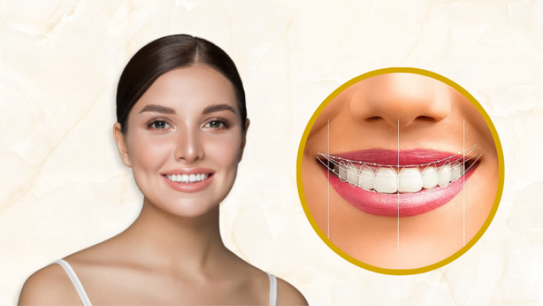 Affordable Digital Smile Design Options