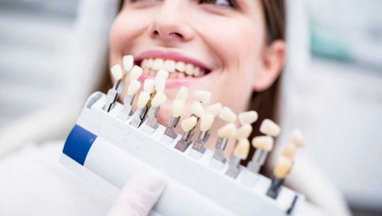 Why E-max Veneers Are the Future of Cosmetic Dentistry