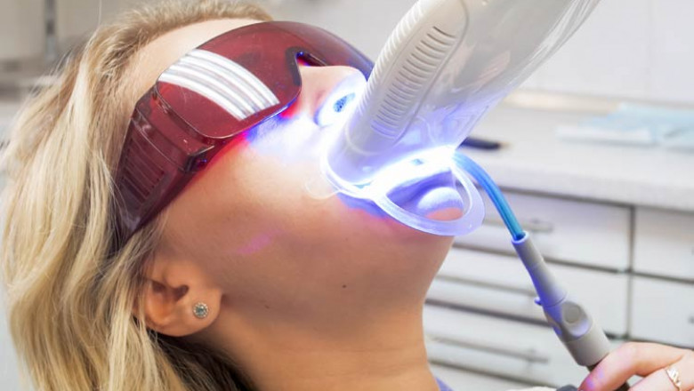 How to Choose the Best Dentist for Your Zoom Teeth Whitening Session