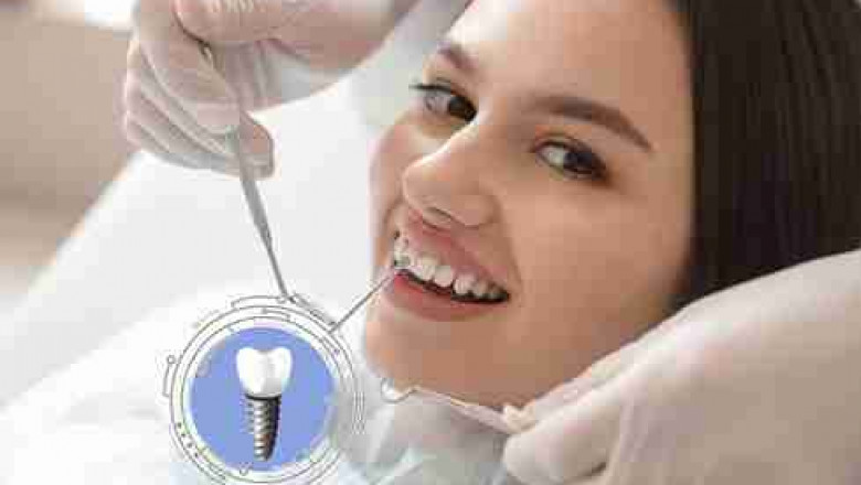 Secure and Natural-Looking Tooth Replacement Solutions