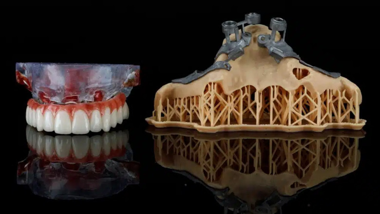 Missing Piece: Rediscover the Joy of Eating with Dental Implants