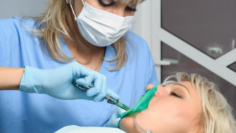 The Ultimate Aftercare Guide for Tooth Extraction Recovery