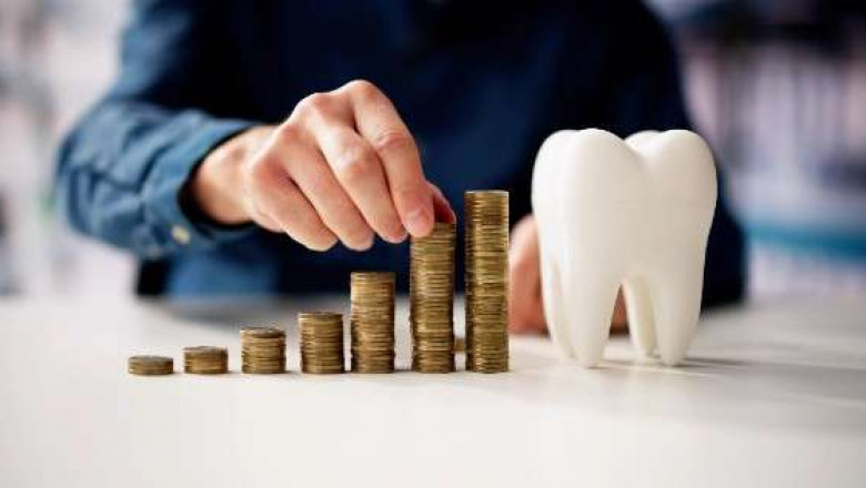 Why Timing Matters Before You Whiten Your Teeth