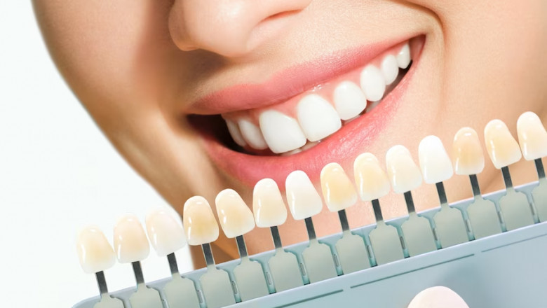 Step-by-Step Guide to Gum Depigmentation Procedures