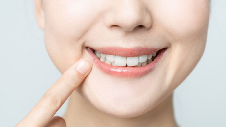 Can Composite Bonding Fix Gaps in Teeth?