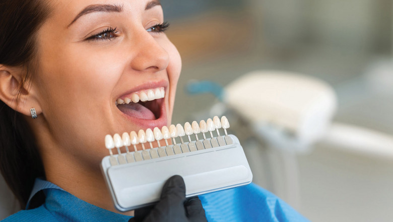 Top Benefits of Choosing E-max Veneers Over Traditional Options