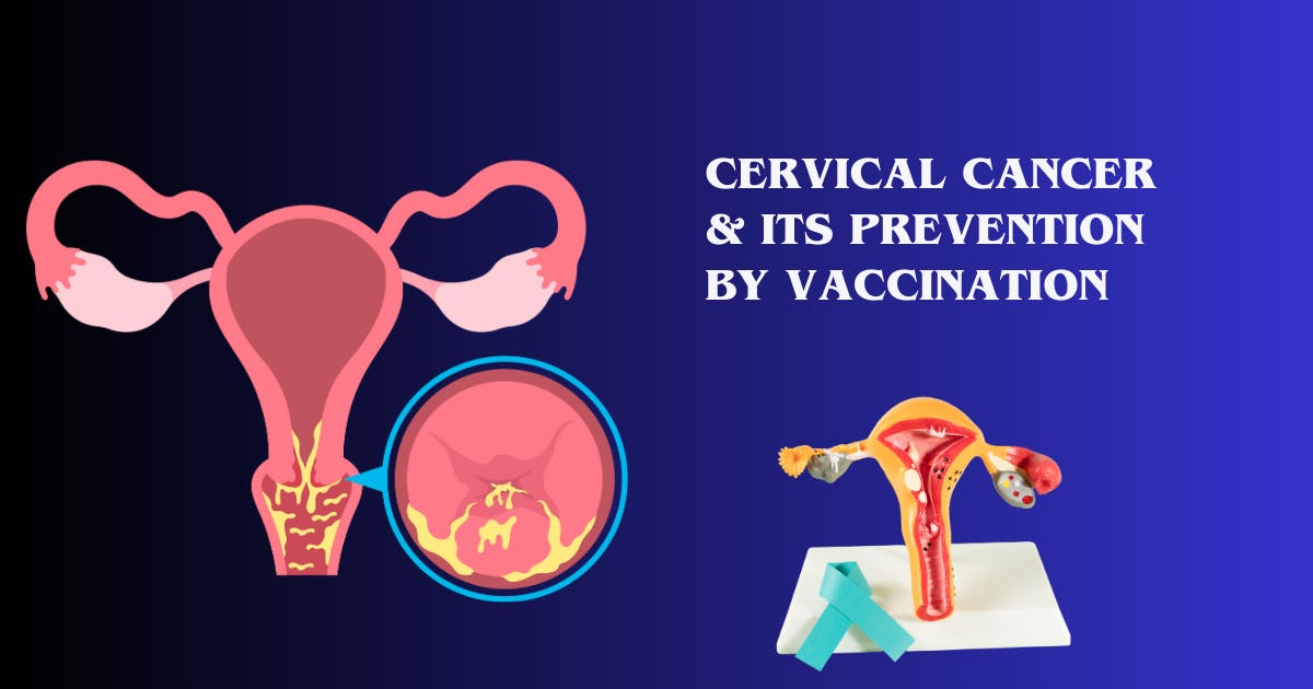 Cervical Cancer & Its Prevention by Vaccination